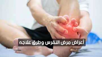 مرض النقرس وطرق علاجه | تعقب